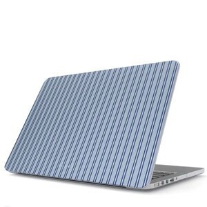Striped Blue MacBook Case Cover - Blue Accent